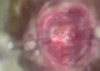 Close-up zoo sex with speculum in a bitch